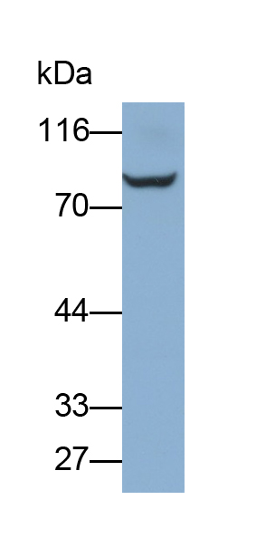 Polyclonal Antibody to Semaphorin 3C (SEMA3C)