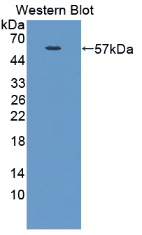 Polyclonal Antibody to NUAK Family SNF1 Like Kinase 1 (NUAK1)