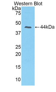 Polyclonal Antibody to Prolactin Induced Protein (PIP)