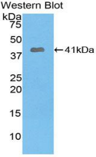 Polyclonal Antibody to Pygopus Homolog 1 (PYGO1)