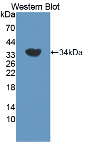 Polyclonal Antibody to Related To Receptor Tyrosine Kinase (RYK)