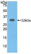 Polyclonal Antibody to Related To Receptor Tyrosine Kinase (RYK)