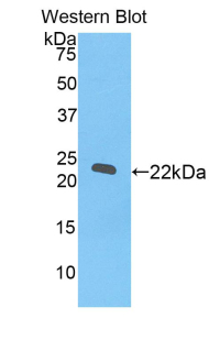 Polyclonal Antibody to RNA Exonuclease 2 Homolog (REXO2)