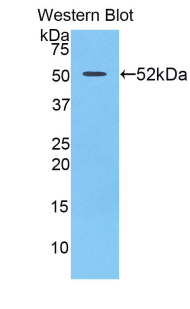 Polyclonal Antibody to Uracil Phosphoribosyltransferase (UPRT)