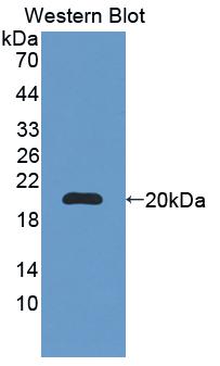 Polyclonal Antibody to BRCA1/BRCA2 Containing Complex Subunit 3 (BRCC3)