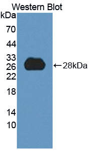 PAN468Hu01.jpg