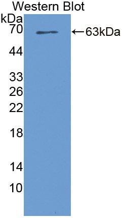 Polyclonal Antibody to Serine/Threonine Kinase 39 (STK39)