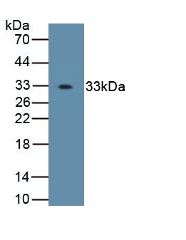 Polyclonal Antibody to Osterix (OSX)