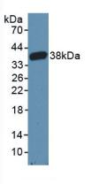 Polyclonal Antibody to Caspase Recruitment Domain Family, Member 9 (CARD9)