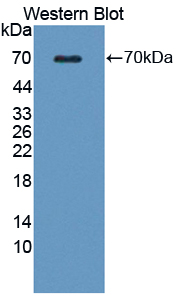 Polyclonal Antibody to Wingless Type MMTV Integration Site Family, Member 16 (WNT16)