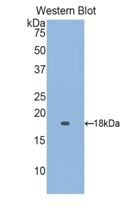 Polyclonal Antibody to Retinol Binding Protein 5, Cellular (RBP5)