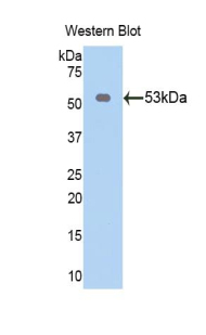 PAP358Hu81.jpg