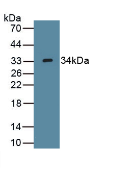 PAP546Hu01.jpg