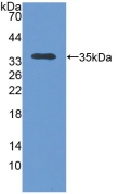 Polyclonal Antibody to Translocase Of Outer Mitochondrial Membrane 70A (TOMM70A)