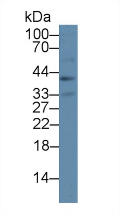 PAP778Hu08.jpg