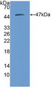 Polyclonal Antibody to Proteasome 26S Subunit, Non ATPase 13 (PSMD13)