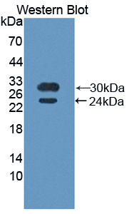 PAQ164Hu01.jpg