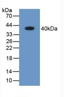 Polyclonal Antibody to Aldose Reductase Like Protein 1 (ARL1)