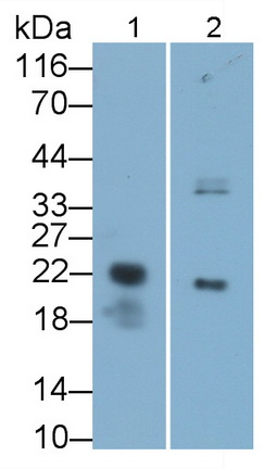 PAS158Hu01.jpg