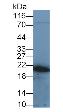 Recombinant Antibody to Tumor Necrosis Factor Alpha (TNFa)