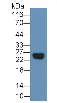 Recombinant Antibody to C Reactive Protein (CRP)