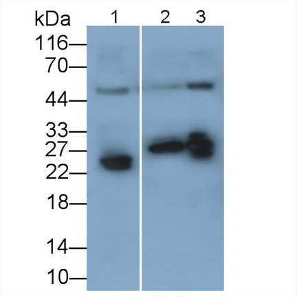 Recombinant Antibody to C Reactive Protein (CRP)