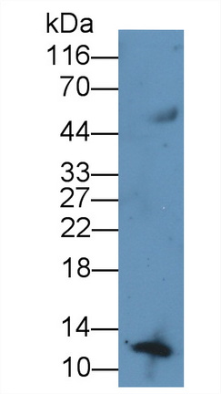 Recombinant Antibody to Serum Amyloid A (SAA)