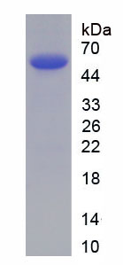 Recombinant Activated Leukocyte Cell Adhesion Molecule (ALCAM)