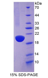 Recombinant Angiotensin I Converting Enzyme (ACE)