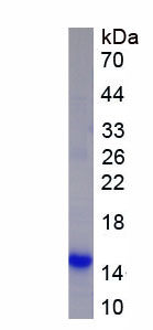 Recombinant Interleukin 8 Receptor Alpha (IL8Ra)