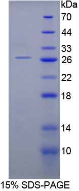 Recombinant Ciliary Neurotrophic Factor (CNTF)