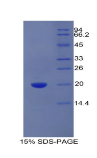 Recombinant Endothelial protein C receptor (EPCR)