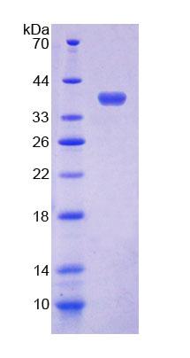 Recombinant Eosinophil Chemotactic Factor (ECF)