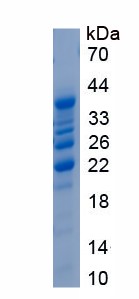 Recombinant Eosinophil Chemotactic Factor (ECF)