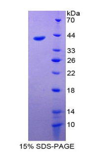 Recombinant Eosinophil Chemotactic Factor (ECF)