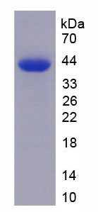 Recombinant Erythropoietin (EPO)