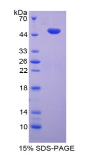 Recombinant Factor Related Apoptosis Ligand (FASL)