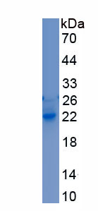 Recombinant FMS Like Tyrosine Kinase 3 Ligand (Flt3L)