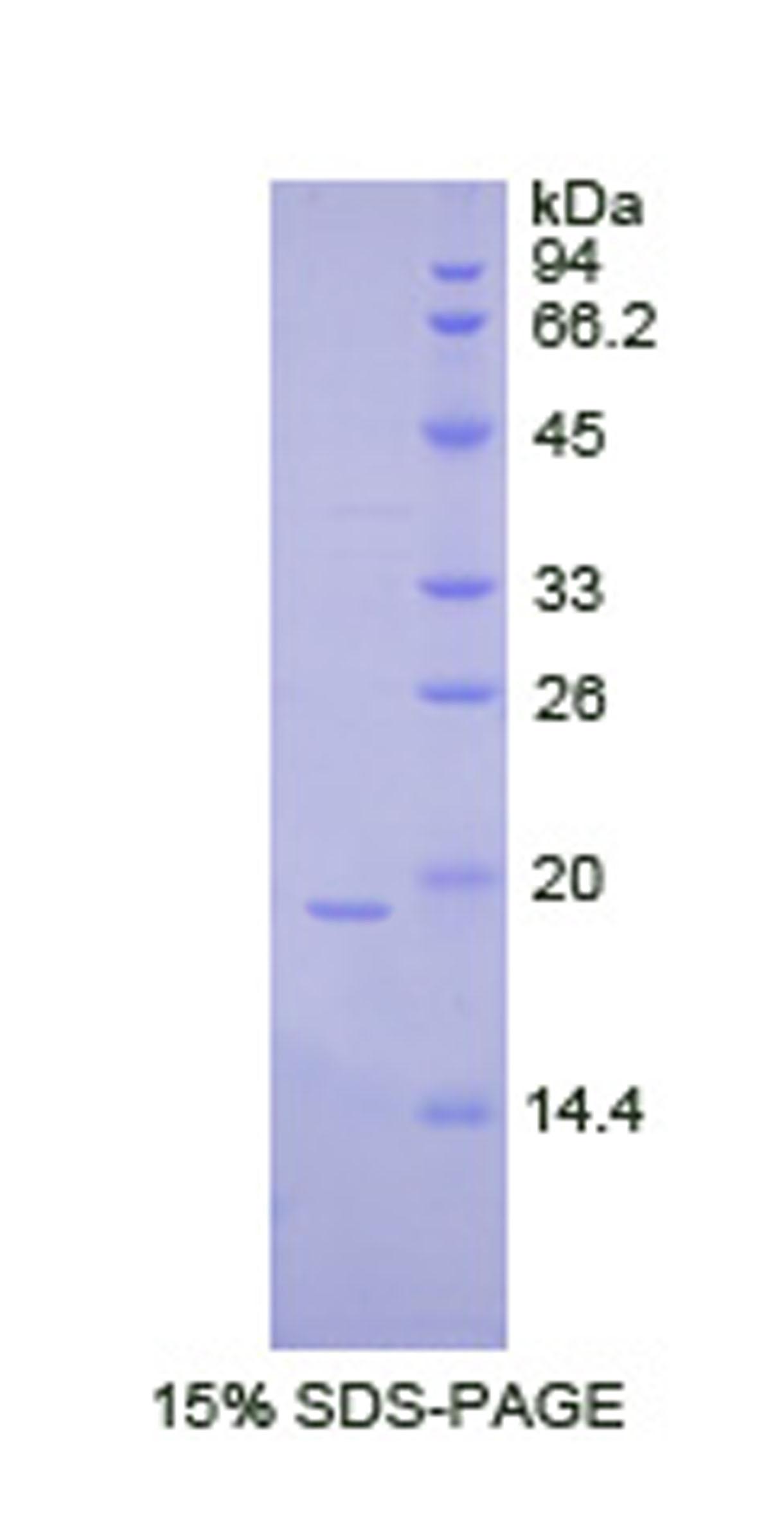 RPA042Hu01.jpg