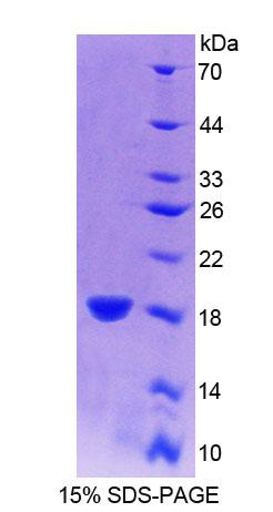 Recombinant Interferon Gamma (IFNg)