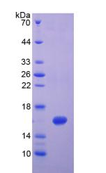 Recombinant Interferon Gamma (IFNg)