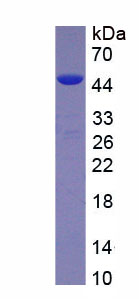 Recombinant Insulin Like Growth Factor 1 (IGF1)