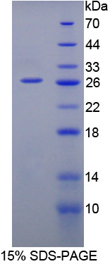 Recombinant Interleukin 12A (IL12A)