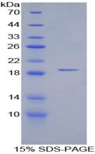 Recombinant Interleukin 15 (IL15)