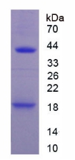 Recombinant Interleukin 1 Receptor Type I (IL1R1)