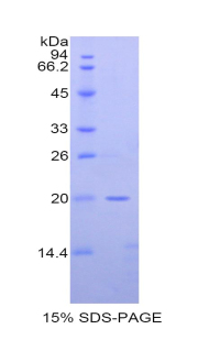 Recombinant Meningioma Expressed Antigen 5 (MGEA5)