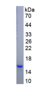 Recombinant Meningioma Expressed Antigen 5 (MGEA5)