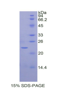 RPA071Eq01.jpg