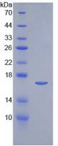 Recombinant Interleukin 2 (IL2)