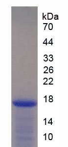 Recombinant Interleukin 2 (IL2)